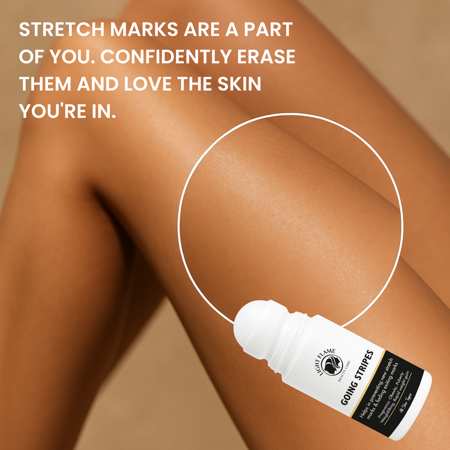Going Stripes – 3-Week Intense Stretch Mark Eraser | Light Flame Beauty Care
