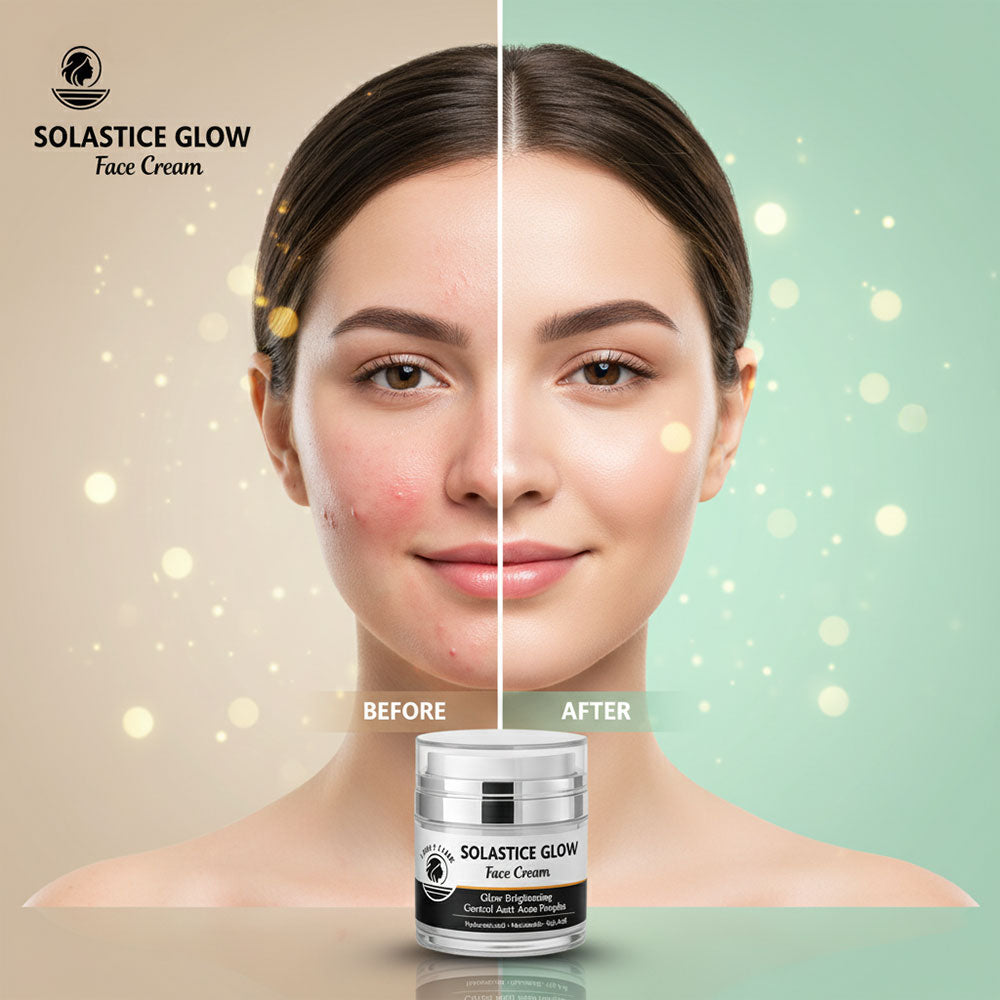 Solastice Glow Face Cream – Glow Brightening & Anti-Acne Moisturizer | Light Flame Beauty Care