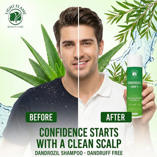 Say Goodbye to Dandruff with LIGHT FLAME BEAUTY CARE Dandrozil Anti-Dandruff Shampoo