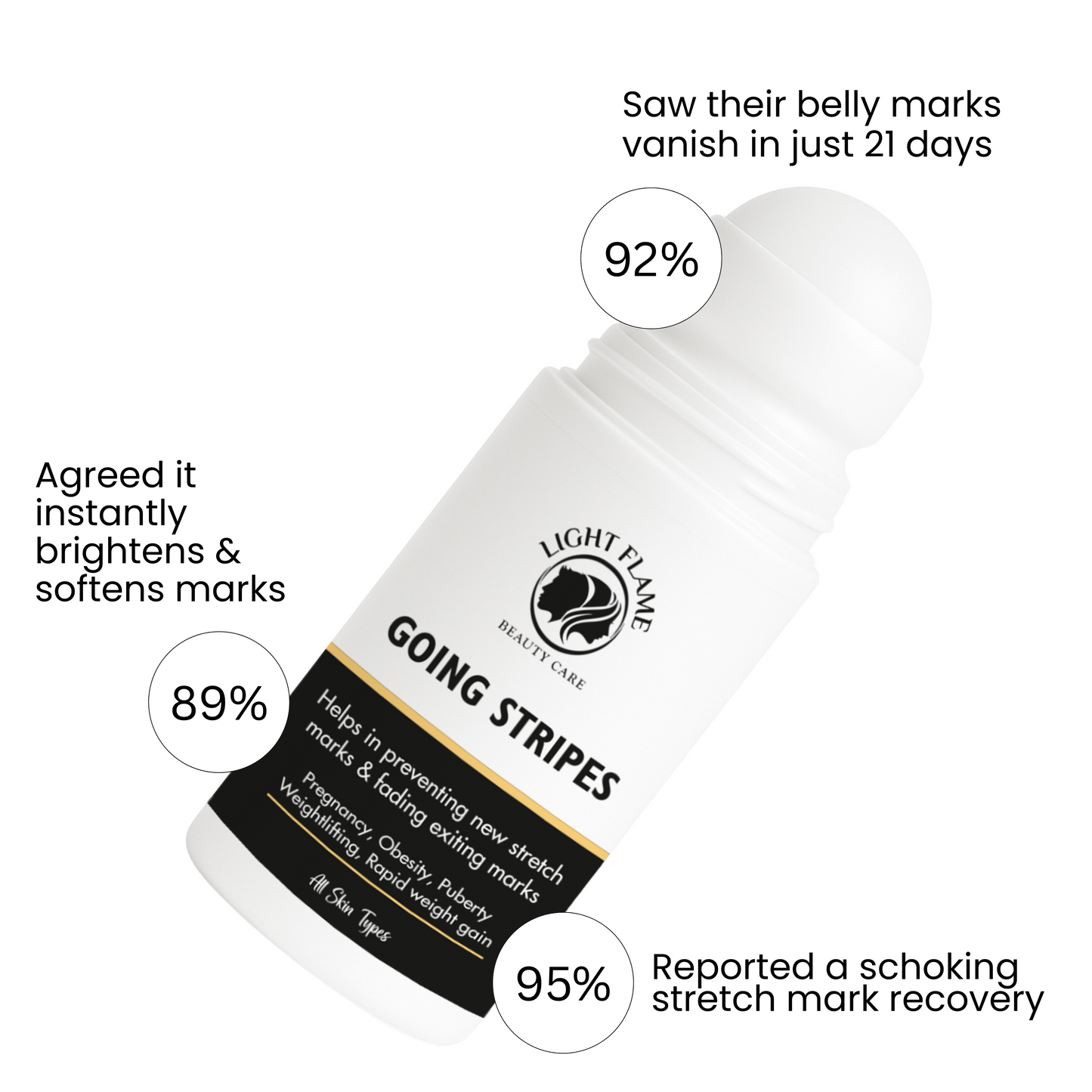 Going Stripes – 3-Week Intense Stretch Mark Eraser | Light Flame Beauty Care