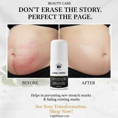Going Stripes – 3-Week Intense Stretch Mark Eraser | Light Flame Beauty Care